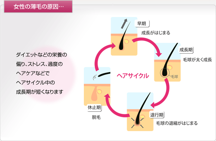 女性の薄毛の原因・・・|ダイエットなどの栄養の偏り、ストレス、過度のヘアケアなどでヘアサイクル中の成長期が短くなります